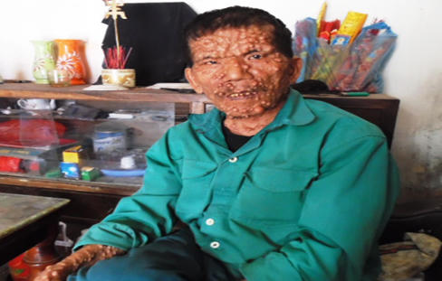 Nỗi lòng của “dị nhân” nhặt rác 